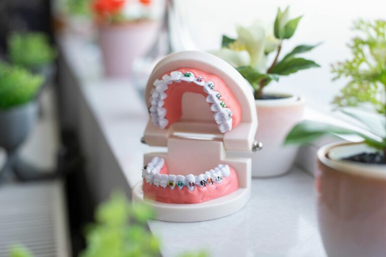 Getting braces is a big decision and it’s important to understand all of the ins and outs before making a commitment.